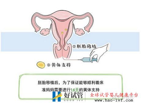 女人做试管过程痛苦吗(图5)