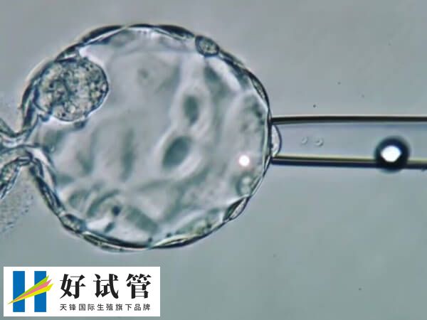 二代试管婴儿采用单精子注射技术