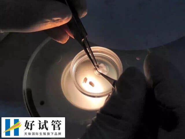 胚胎染色体非整倍体是一种较为复杂的情况
