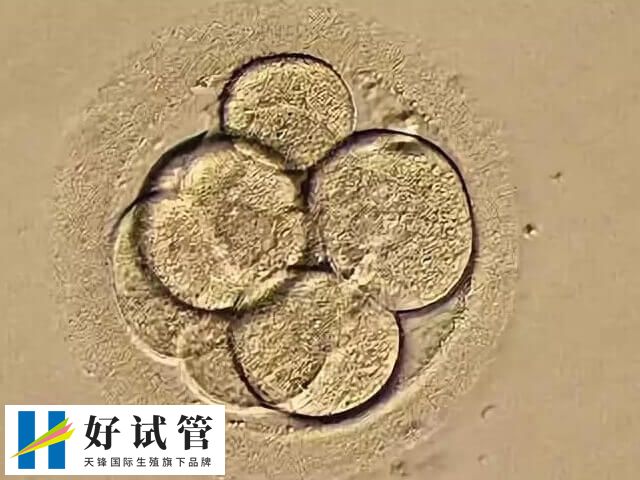 如何改善一卵多精的情况(图1) 一卵多精可考虑辅助孵化技术改善